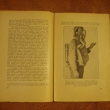 L�ka� a samarit�n 1921, str. 292 - 293